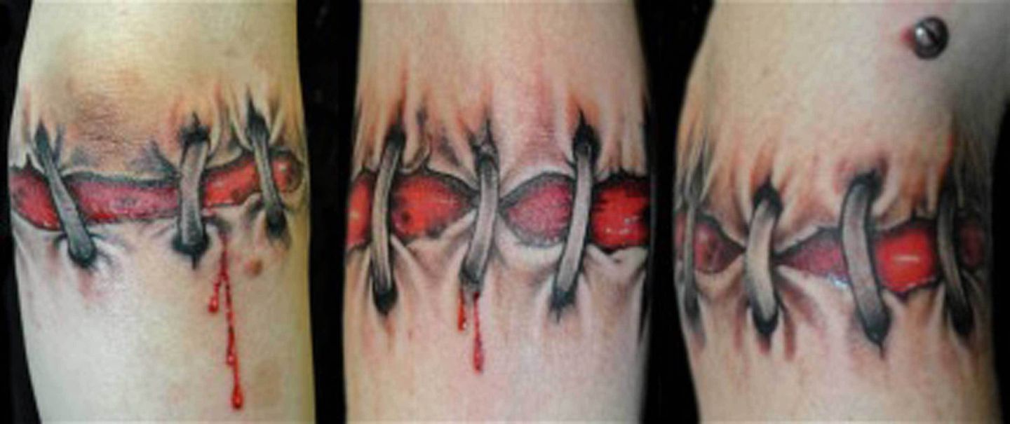 Torn_scar_tattoo_by_tony_styles