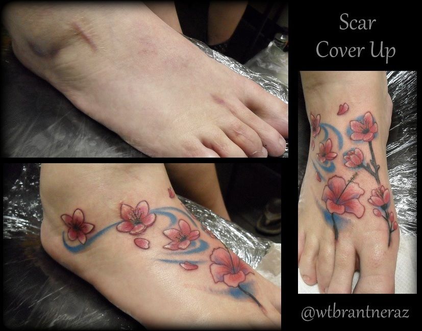 Foot_scar_cover_up